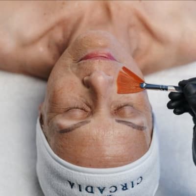 SWiCH™ Treatment Package at the Treatment Lounge: Studio 11C in Lake Forest, CA